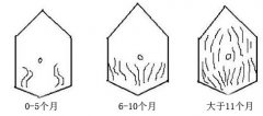 û